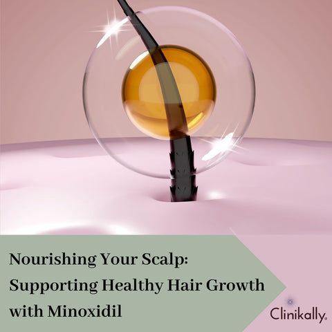 Nourishing Your Scalp: Supporting Healthy Hair Growth with Minoxidil