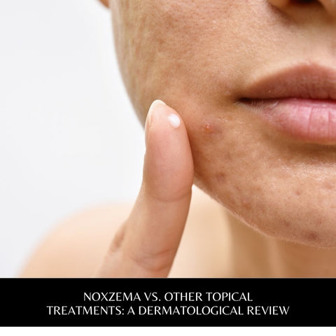 Noxzema vs. Other Topical Treatments: A Dermatological Review