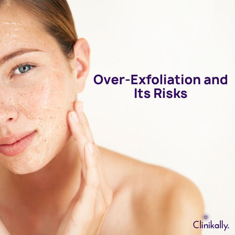 Over-Exfoliation and Its Risks
