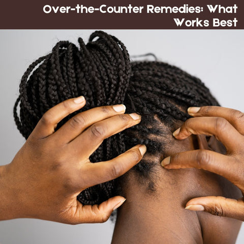 Over-the-Counter Remedies: What Works Best