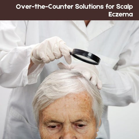 Over-the-Counter Solutions for Scalp Eczema