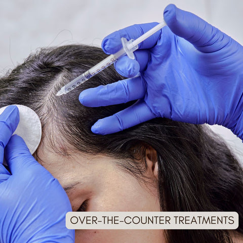 Over-the-Counter Treatments