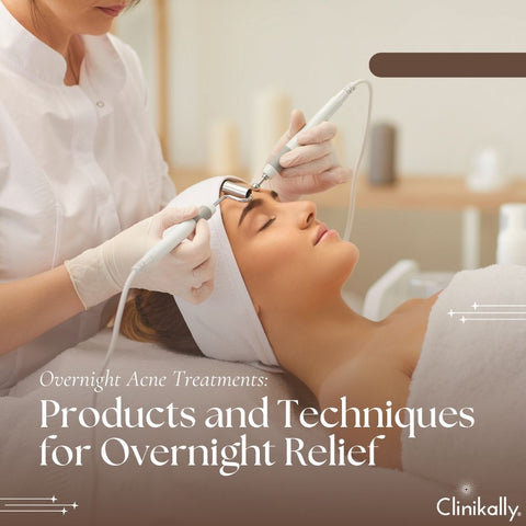 Overnight Acne Treatments: Products and Techniques for Overnight Relief