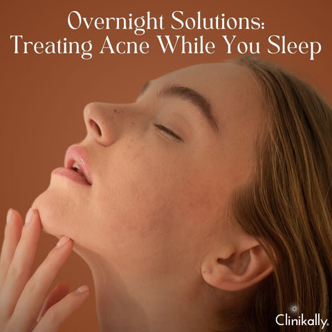 Overnight Solutions: Treating Acne While You Sleep