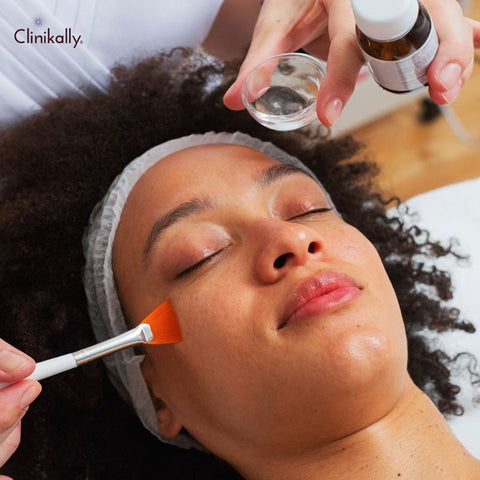 Overview of chemical peels for tan removal