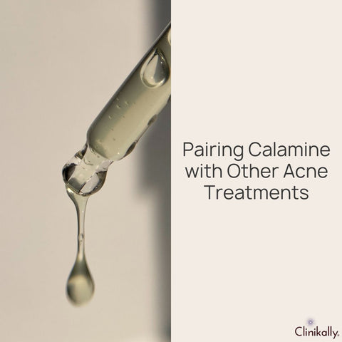 Pairing Calamine with Other Acne Treatments