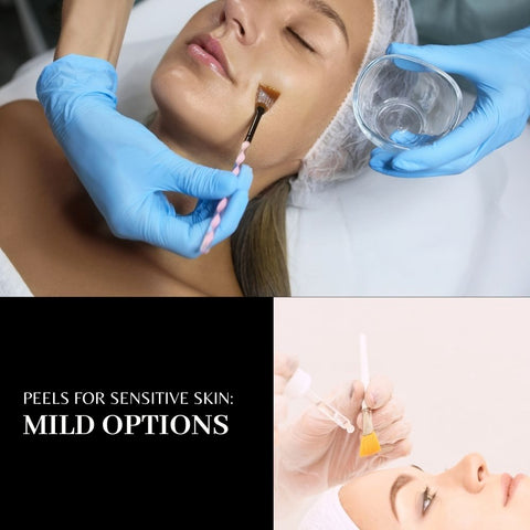 Peels for Sensitive Skin: Mild Options