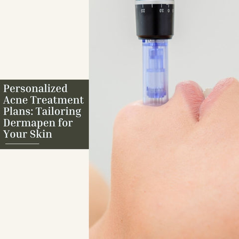 Personalized Acne Treatment Plans: Tailoring Dermapen for Your Skin