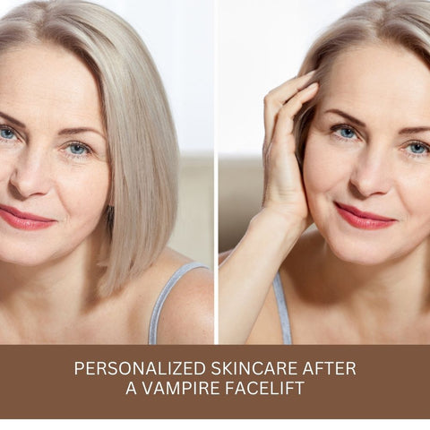 Personalized Skincare After a Vampire Facelift