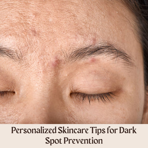 Personalized Skincare Tips for Dark Spot Prevention