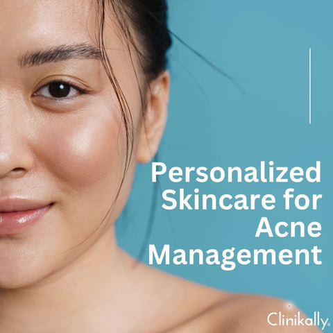 Personalized Skincare for Acne Management