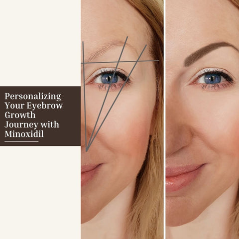 Personalizing Your Eyebrow Growth Journey with Minoxidil