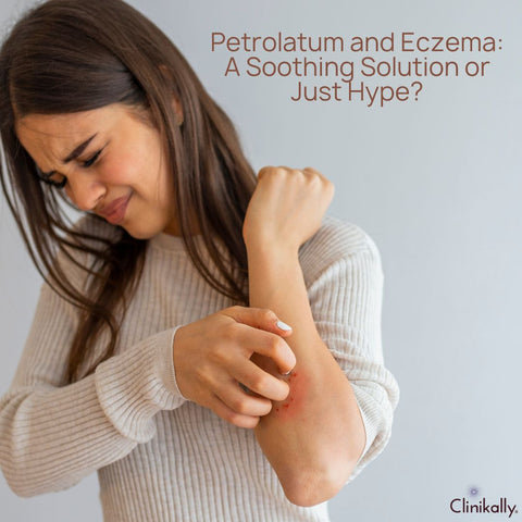 Petrolatum and Eczema: A Soothing Solution or Just Hype?