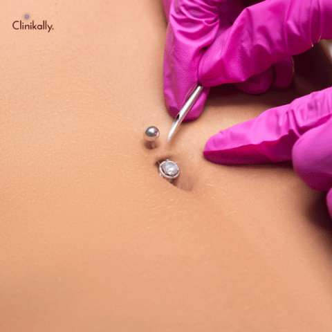 Piercing Bumps and Keloids