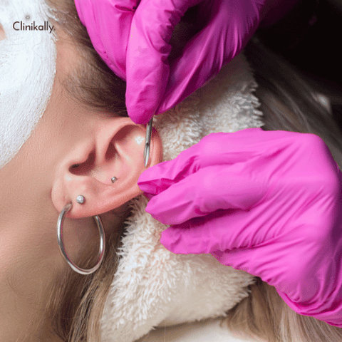 hypertrophic scar