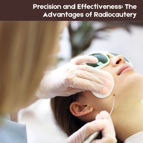 Precision and Effectiveness: The Advantages of Radiocautery