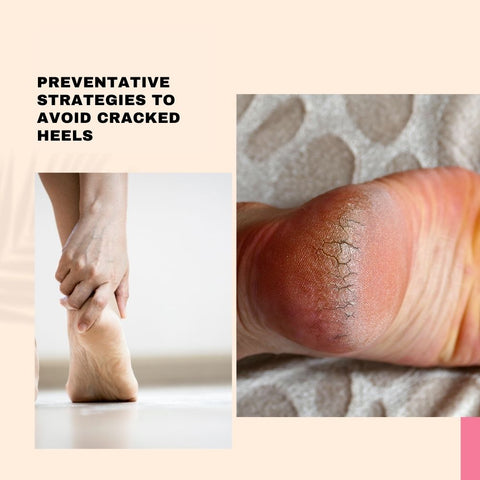 Preventative Strategies to Avoid Cracked Heels
