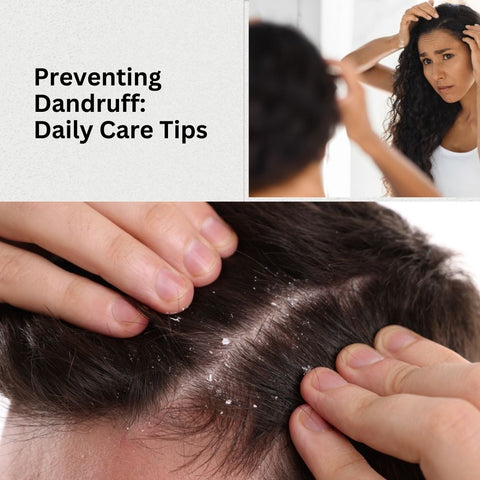 Preventing Dandruff: Daily Care Tips