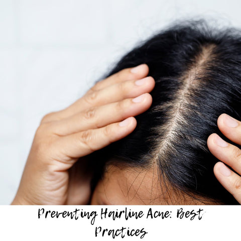 Preventing Hairline Acne: Best Practices