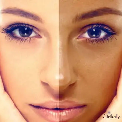 Preventive measures against tanning