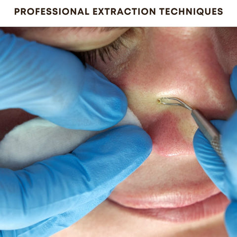 Professional Extraction Techniques