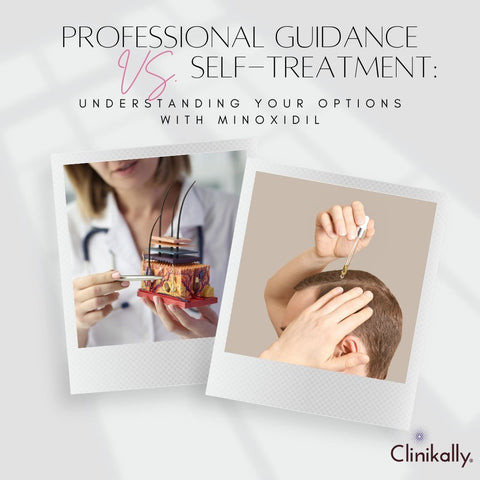 Professional Guidance vs. Self-Treatment: Understanding Your Options with Minoxidil