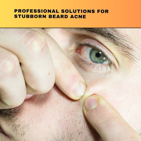 Professional Solutions for Stubborn Beard Acne