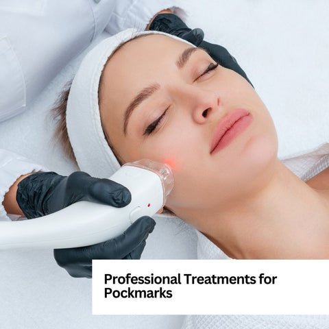 Professional Treatments for Pockmarks