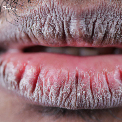 lip balm vs lip gloss