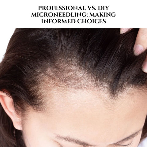 Professional vs. DIY Microneedling: Making Informed Choices