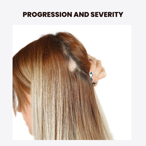 Progression and Severity