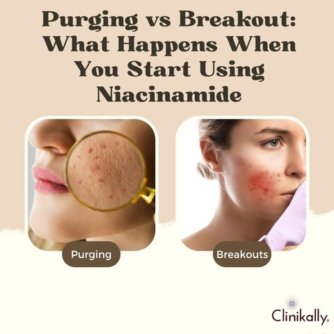Difference Between Purging and Regular Breakouts