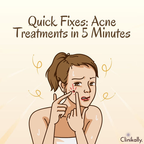 Quick Fixes: Acne Treatments in 5 Minutes