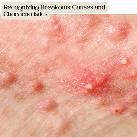 Recognizing Breakouts: Causes and Characteristics