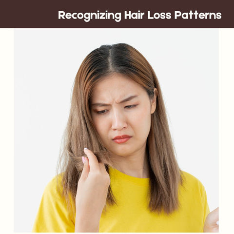 Recognizing Hair Loss Patterns
