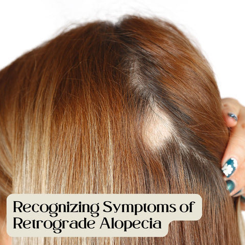 Recognizing Symptoms of Retrograde Alopecia