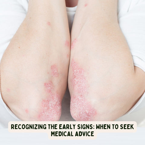 Recognizing the Early Signs: When to Seek Medical Advice