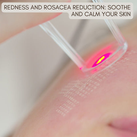 Redness and Rosacea Reduction: Soothe and Calm Your Skin