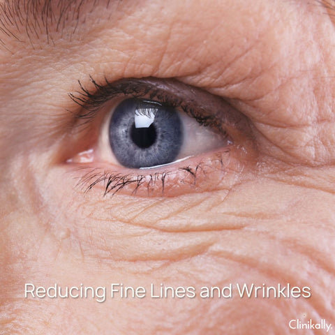 Reducing Fine Lines and Wrinkles