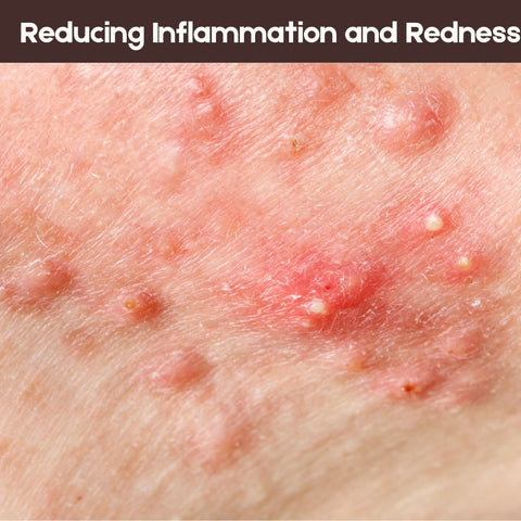 Reducing Inflammation and Redness