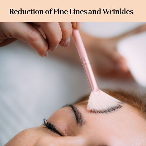 Reduction of Fine Lines and Wrinkles