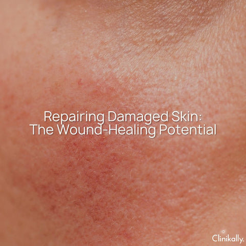 Repairing Damaged Skin: The Wound-Healing Potential