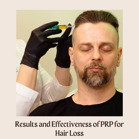 Results and Effectiveness of PRP for Hair Loss