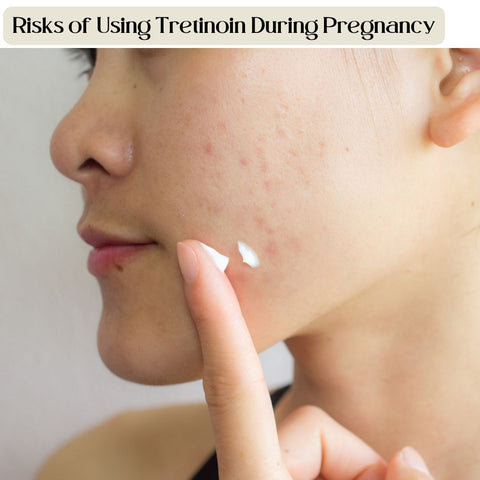 Risks of Using Tretinoin During Pregnancy