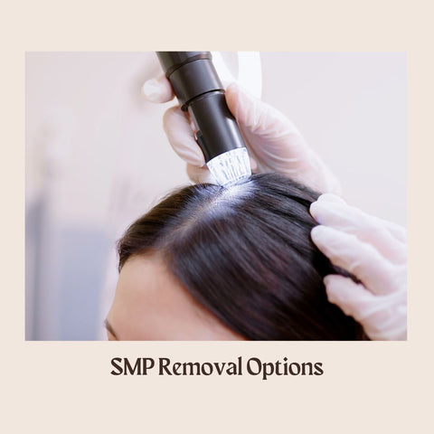 SMP Removal Options