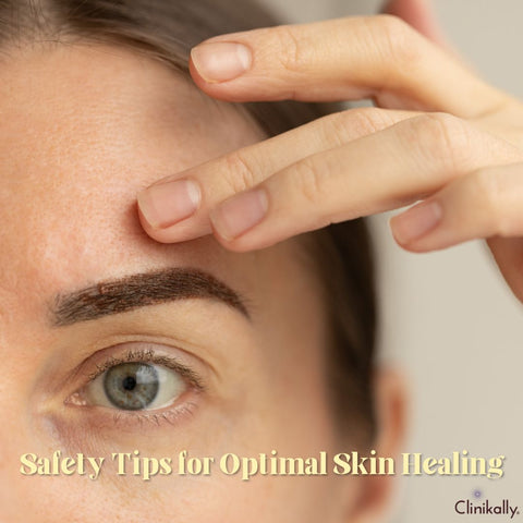 Safety Tips for Optimal Skin Healing