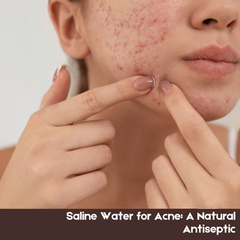Saline Water for Acne: A Natural Antiseptic