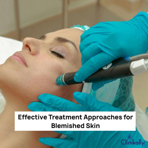 Effective Treatment Approaches for Blemished Skin