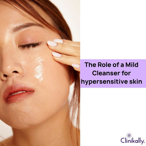 The Role of a Mild Cleanser for hypersensitive skin