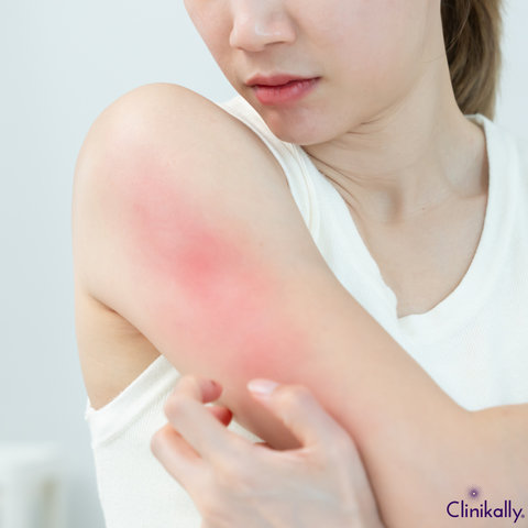 Potential Side Effects and Aftercare Guidelines